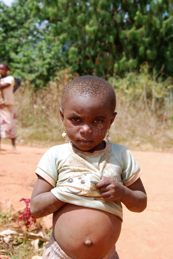Le Ventre Gonfle D Un Enfant Africain Photo Editorial Image Du Pauvrete Solidarite Le Ventre Gonfle D Un Enfant Africain Photo Editorial Image Du Pauvrete Solidarite
