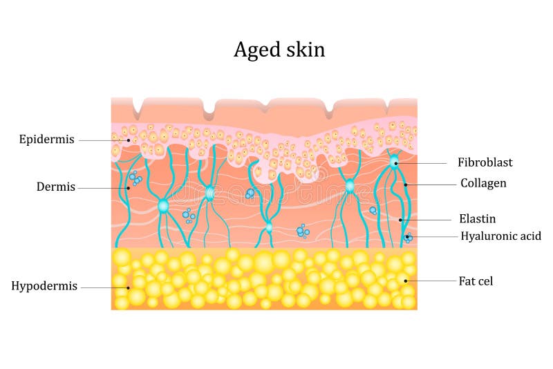 Aged skin layer. Human skin structure with collagen and elastane fibers, hyaluronic acids, fibroblasts. Schematic illustration. Vector diagram. Illustration about health care and beauty. Aged skin layer. Human skin structure with collagen and elastane fibers, hyaluronic acids, fibroblasts. Schematic illustration. Vector diagram. Illustration about health care and beauty
