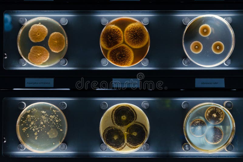 Verschillende steekproeven met soorten bacterias die bij gemeenschappelijke huishoudenpunten leven alternaria arborescens, monasc stock afbeeldingen Verschillende steekproeven met soorten bacterias die bij gemeenschappelijke huishoudenpunten leven alternaria arborescens, monasc stock afbeeldingen