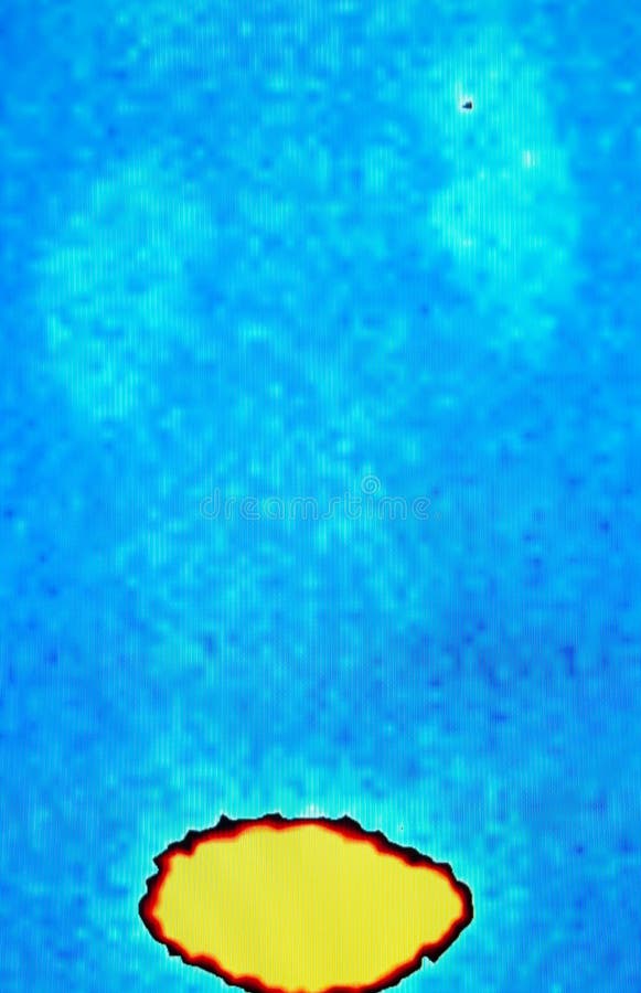 Vescica, medicina nucleare fotografie stock libere da diritti Vescica, medicina nucleare fotografie stock libere da diritti