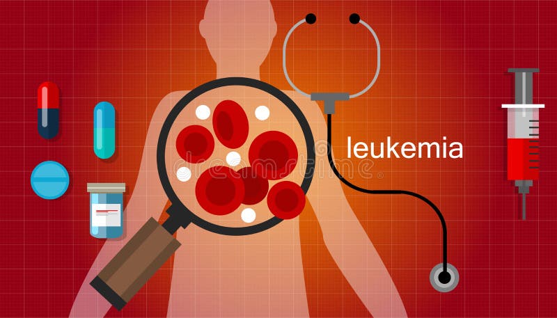 Vetor do conceito da doença da leucemia do sangue do câncer da leucemia ilustração do vetor Vetor do conceito da doença da leucemia do sangue do câncer da leucemia ilustração do vetor