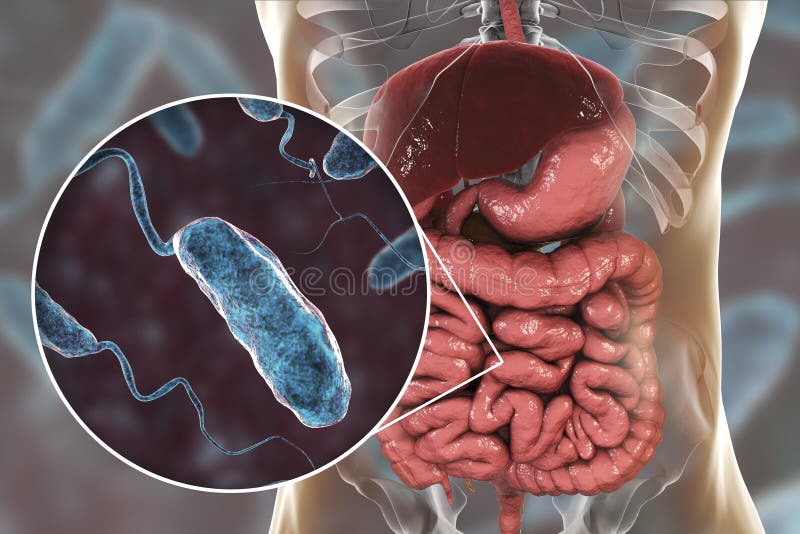 Vibrio Cholerae Bacteria in Small Intestine Stock Illustration