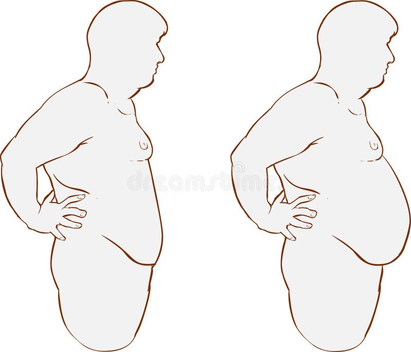 A vector illustration of Fat belly before and after treatment. A vector illustration of Fat belly before and after treatment