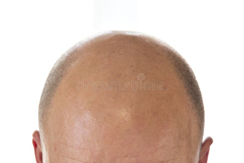 367 Top View Bald Head Stock Photos Free And Royalty Free Stock Photos