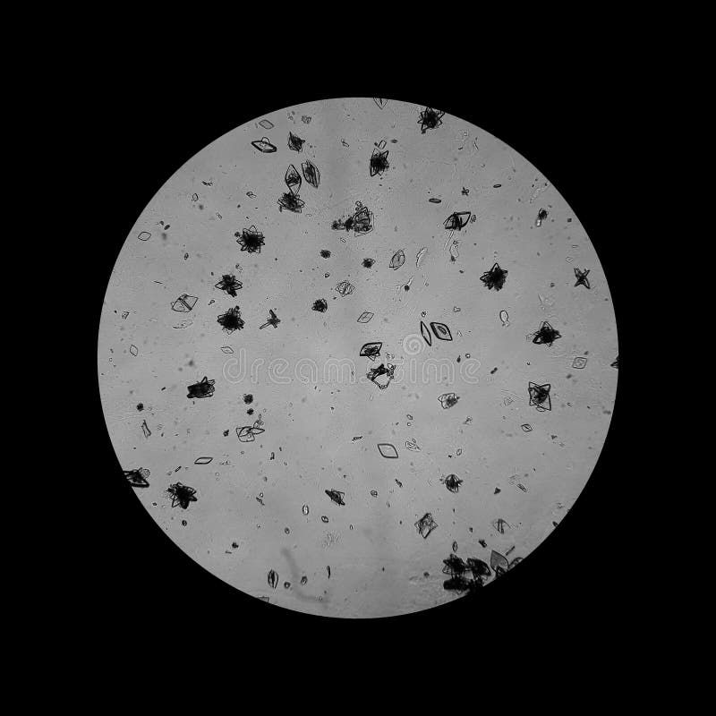 Severe Dehydration Stock Photos Free & RoyaltyFree Stock Photos from