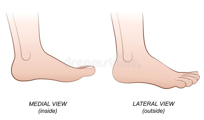 Vista mediale laterale del piede dentro il profilo esterno