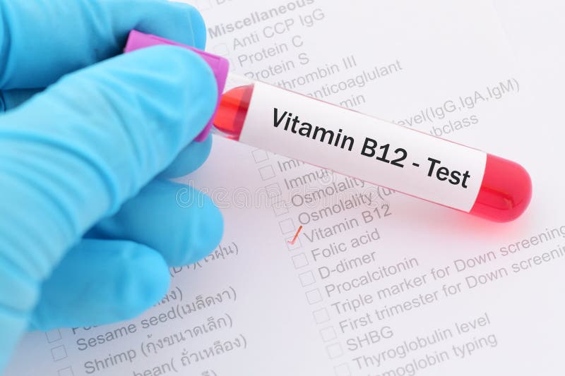 Vitamin B12 Stock Images Download 762 Royalty Free Photos