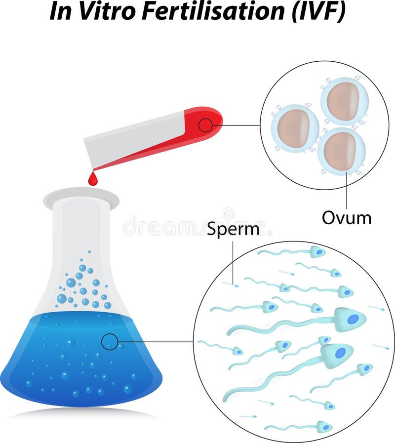 In vitro fecundação ilustração do vetor In vitro fecundação ilustração do vetor