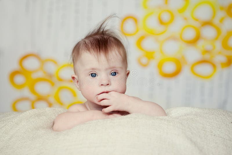 Vrolijk verslaat weinig babymeisje met Syndroom royalty-vrije stock afbeeldingen Vrolijk verslaat weinig babymeisje met Syndroom royalty-vrije stock afbeeldingen