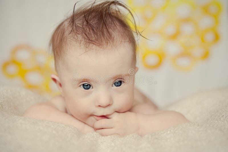 Vrolijk verslaat weinig babymeisje met Syndroom stock afbeelding Vrolijk verslaat weinig babymeisje met Syndroom stock afbeelding