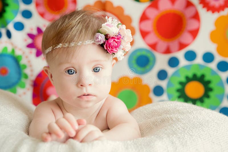 Vrolijk verslaat weinig babymeisje met Syndroom royalty-vrije stock foto Vrolijk verslaat weinig babymeisje met Syndroom royalty-vrije stock foto