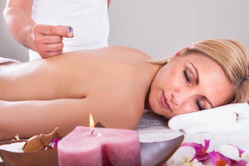 Vrouw die een Acupunctuurtherapie ontvangen stock fotografie Vrouw die een Acupunctuurtherapie ontvangen stock fotografie
