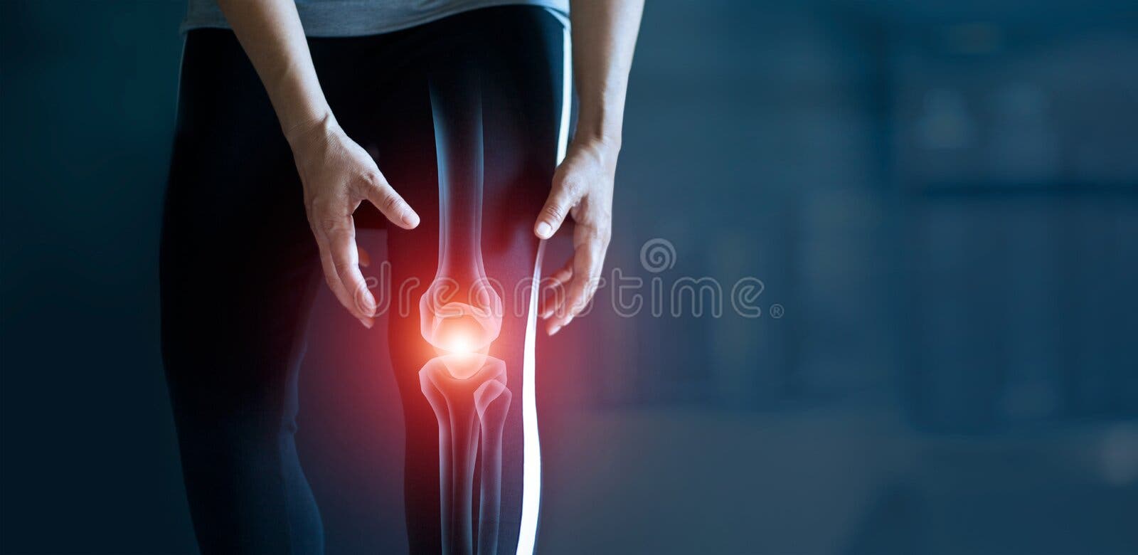 Vrouw die pijn in knieverwonding van training en osteoartritispeesproblemen gewrichtsontsteking en lijden in het donker Vrouw die pijn in knieverwonding van training en osteoartritispeesproblemen gewrichtsontsteking en lijden in het donker
