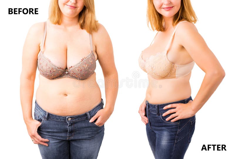 Vrouw before and after het op dieet zijn stock foto Vrouw before and after het op dieet zijn stock foto