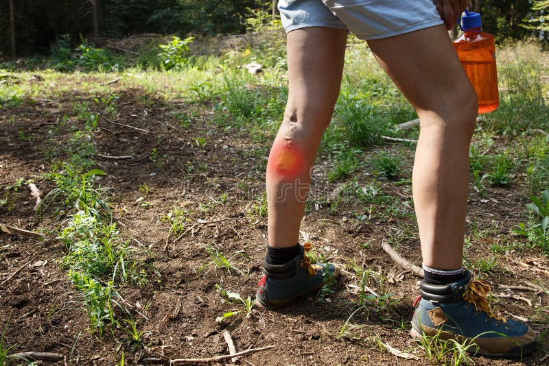 Vrouw met spataders op een wandelingsreis met rood punteffect stock foto Vrouw met spataders op een wandelingsreis met rood punteffect stock foto