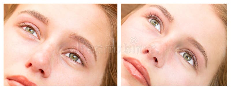 Vrouw op de procedure voor wimperuitbreidingen, royalty-vrije stock afbeeldingen Vrouw op de procedure voor wimperuitbreidingen, royalty-vrije stock afbeeldingen