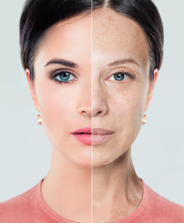 Vrouwenlippen before and after de injecties van de lippenvuller stock afbeelding Vrouwenlippen before and after de injecties van de lippenvuller stock afbeelding