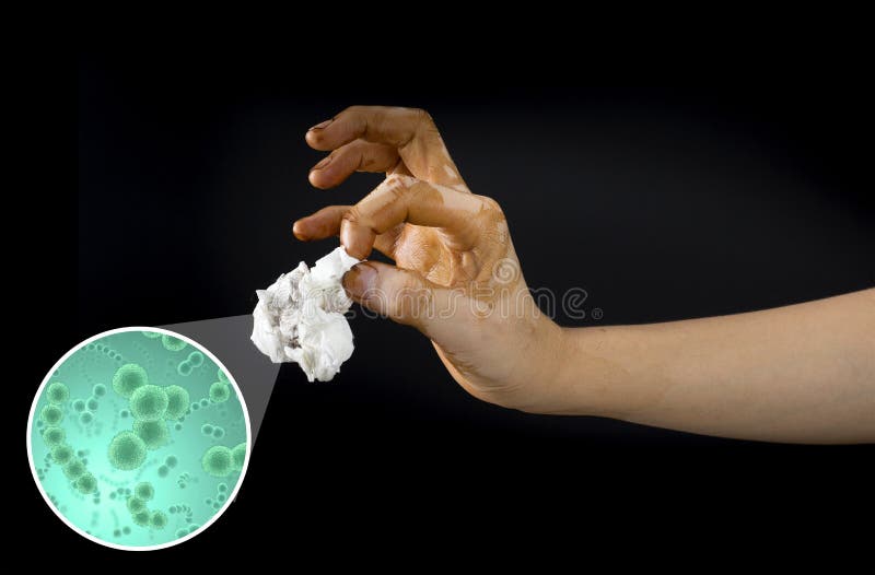 Vuile hand met kiemen en bacteriën stock foto's Vuile hand met kiemen en bacteriën stock foto's