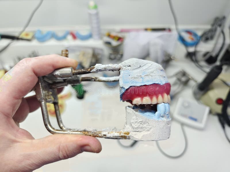 Wax dentures model stock image. Image of medicine, lose 278671115