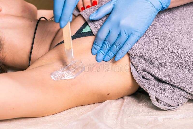 Waxing Woman Armpit. Salon Wax Beautician Epilation Procedure. Waxing Female Body for Hair Removal by Therapist Close Up Stock Image - Image of girl, person: 183514917 Waxing Woman Armpit. Salon Wax Beautician Epilation Procedure. Waxing Female Body for Hair Removal by Therapist Close Up Stock Image - Image of girl, person: 183514917