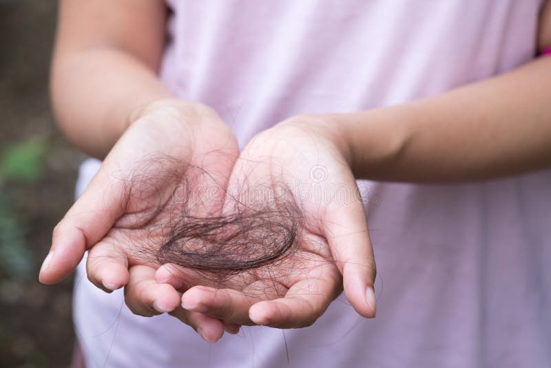 Woman Suffers from Hair Loss. Stock Image - Image of focus, depression:  117276929