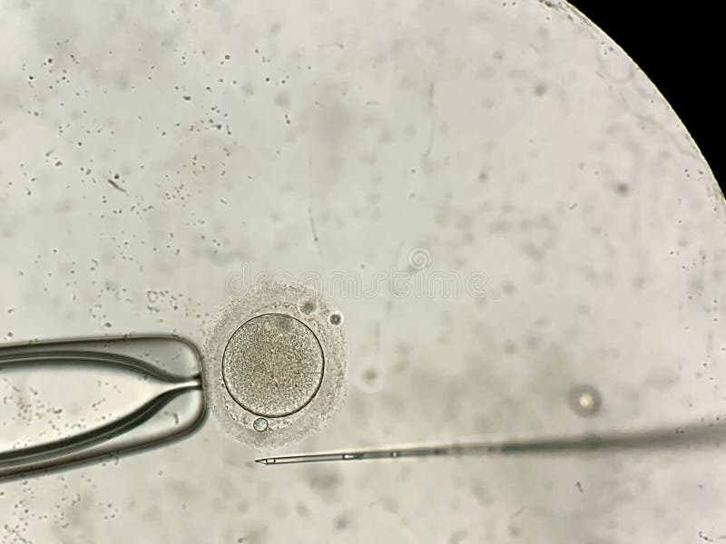 Weergeven door microscoop bij bemestingsprocédé in vitro royalty-vrije stock foto Weergeven door microscoop bij bemestingsprocédé in vitro royalty-vrije stock foto