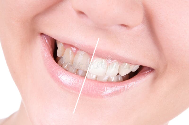 Weiß werdene Zähne. Zahnpflege lizenzfreies stockbild Weiß werdene Zähne. Zahnpflege lizenzfreies stockbild