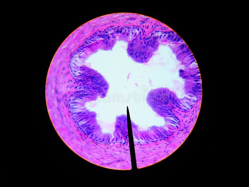 Wet mount vas ductus deferens microscopic cross section view royalty free stock photo Wet mount vas ductus deferens microscopic cross section view royalty free stock photo