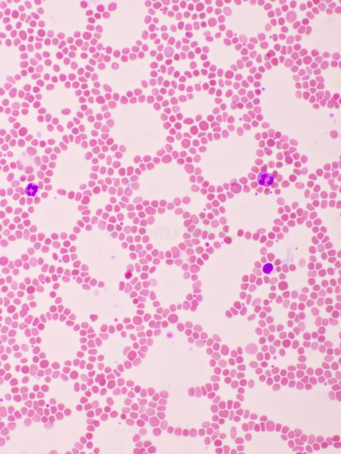 White blood cells and red blood cell on blood smear