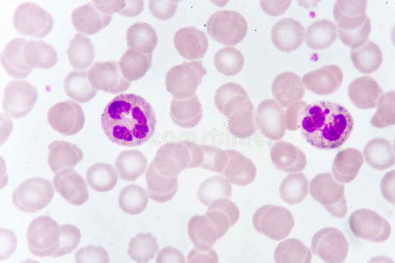 White blood cells in blood smear