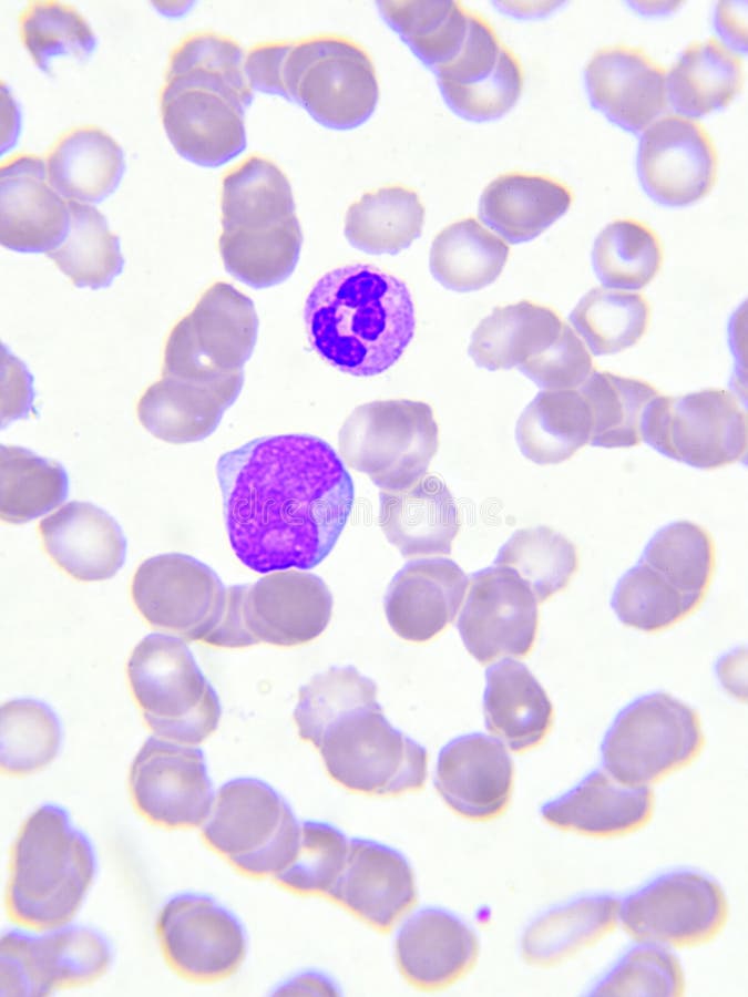 White blood cells stock photo. Image of disease, analyzing 97102004