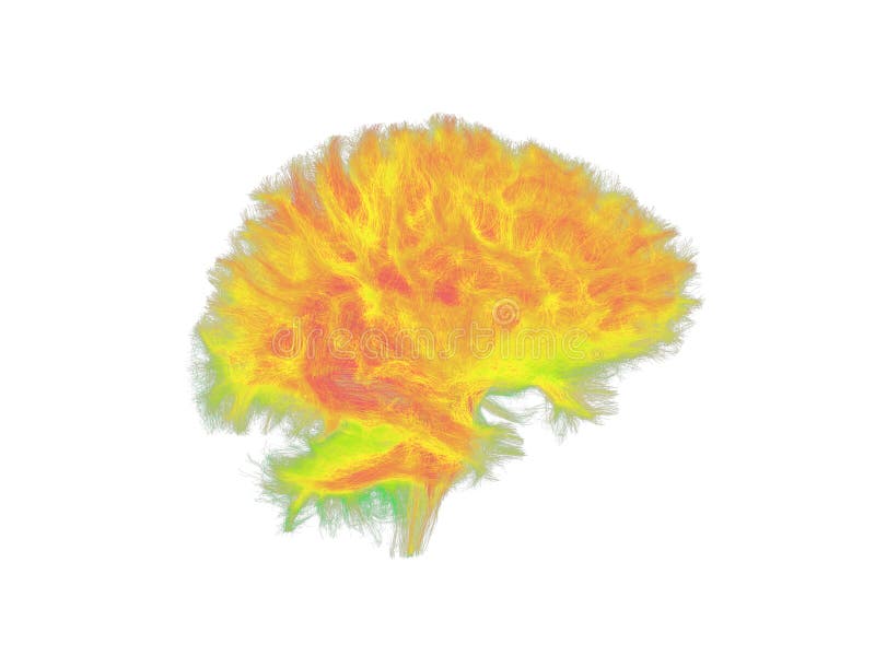 White Matter Tractography of the Human Brain
