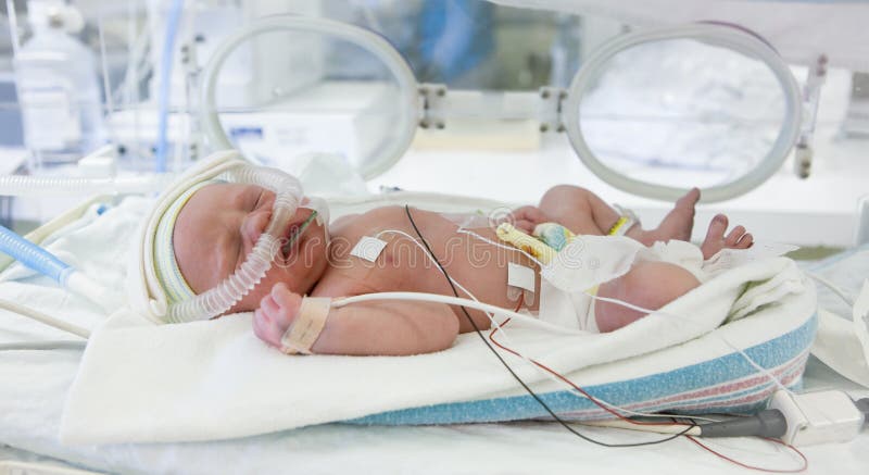 Wizerunek przedwczesny dziecko w inkubatorze