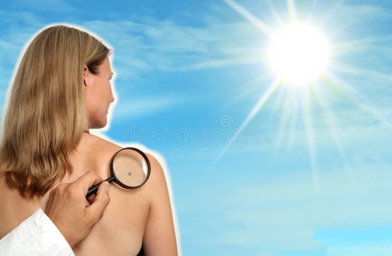 Woman with Birthmark or skin cancer at a skin doctor
