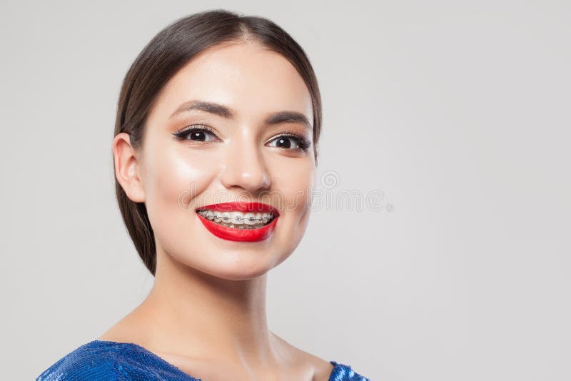 Woman with braces on white teeth. Beautiful woman in braces smiling on white background