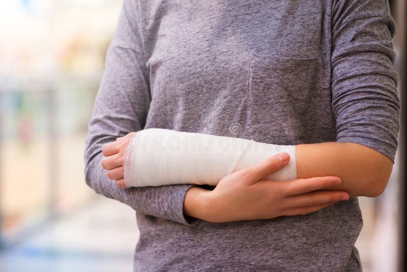 Woman with broken arm royalty free stock images