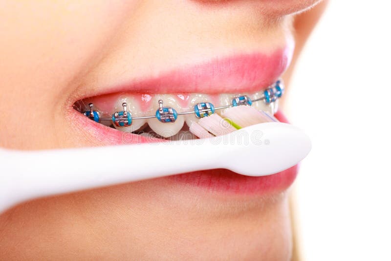 Woman brushing teeth with braces using brush