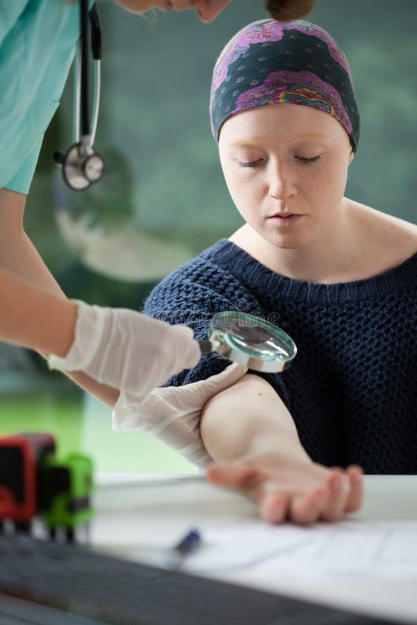 Woman with cancer during mole examining