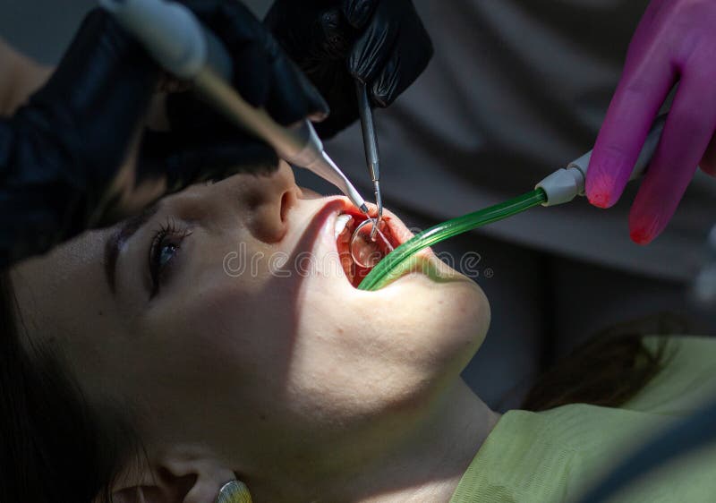 A Woman at a Dentist& X27;s Appointment To Replace Arches with Braces