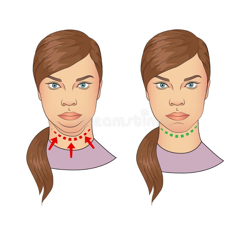 Double Chin Fat Stock Illustrations – 86 Double Chin Fat Stock