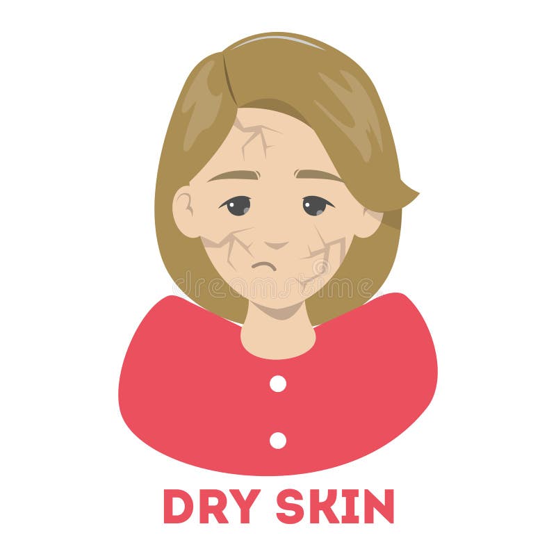 Woman with dry skin on the face. Facial problem stock illustration