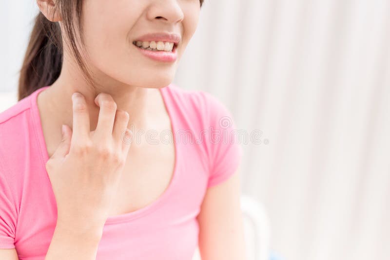 Woman with itchy skin stock photo. Image of care, allergy 96628480