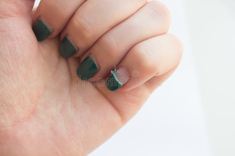 Woman with Old Gel Polish Manicure. Damaged, Peeling, Shabby Gel Polish Stock Photo - Image of hand, female: 185687088 Woman with Old Gel Polish Manicure. Damaged, Peeling, Shabby Gel Polish Stock Photo - Image of hand, female: 185687088