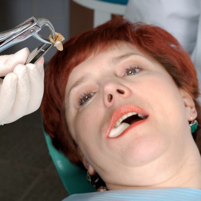 Woman with open mouth look on her extract tooth