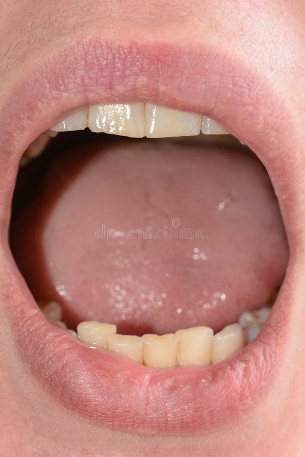 115 Adult Rotten Teeth Photos - Free & Royalty-Free Stock Ph