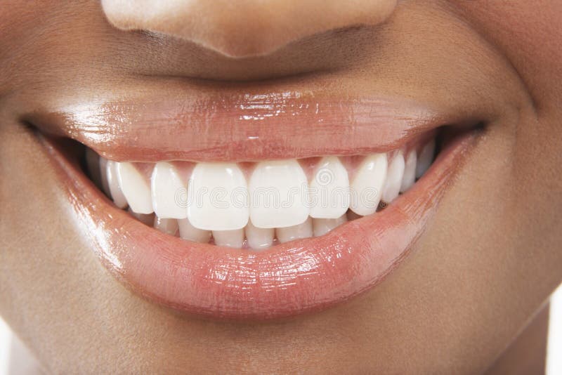 285 762 White Teeth Photos Free Royalty Free Stock Photos From Dreamstime 285 762 White Teeth Photos Free Royalty Free Stock Photos From Dreamstime