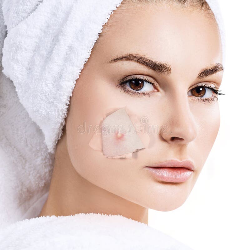 Woman with Pimple on Face Peek from Hole in Foundation. Stock Photo ...