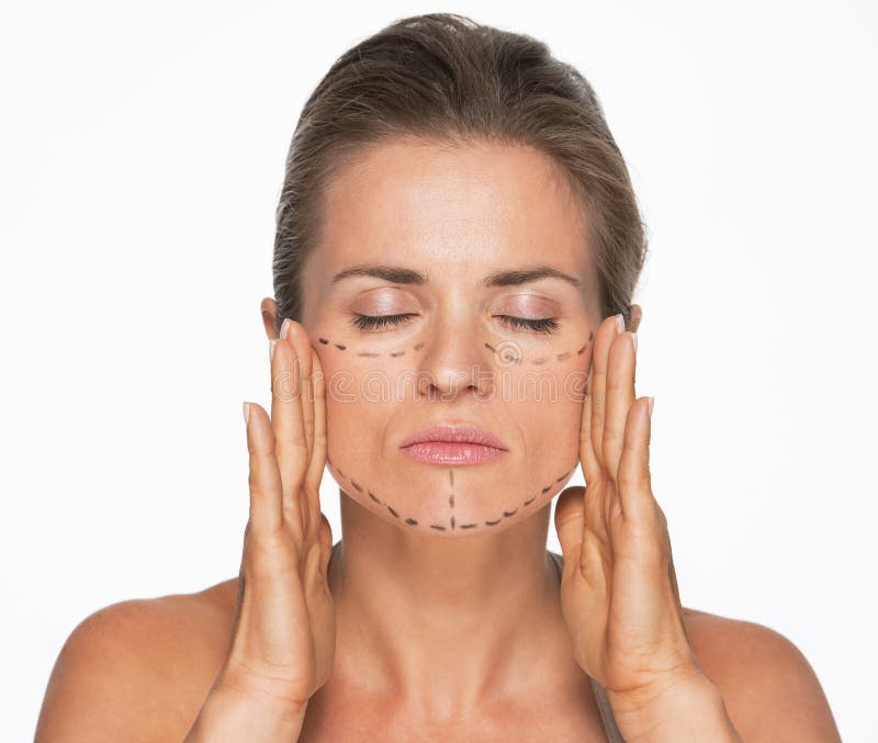 Woman with plastic surgery marks on face stock photo Woman with plastic surgery marks on face stock photo