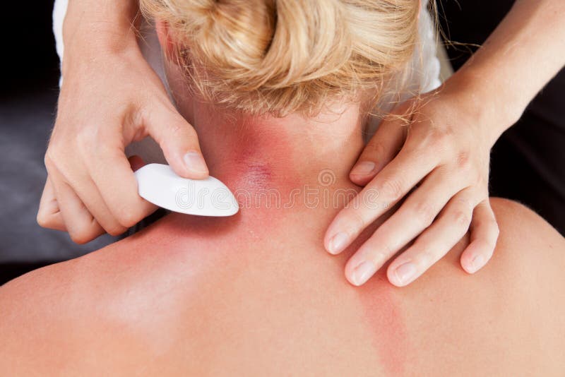 Woman Receiving GuaSha Treatment on Neck