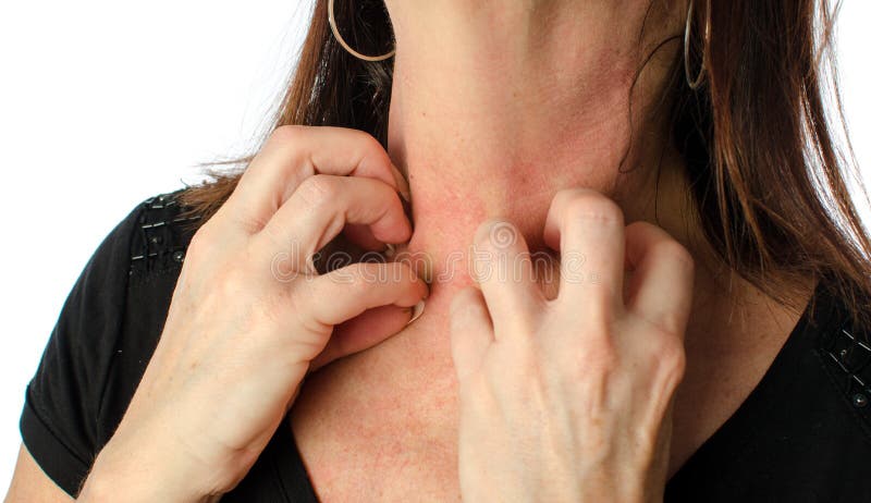 Una mujer rascarse su cuello, en blanco.